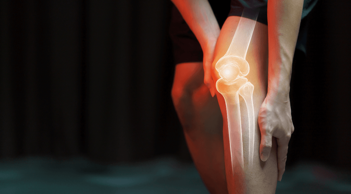 Top 5 Mistakes After Knee Replacement