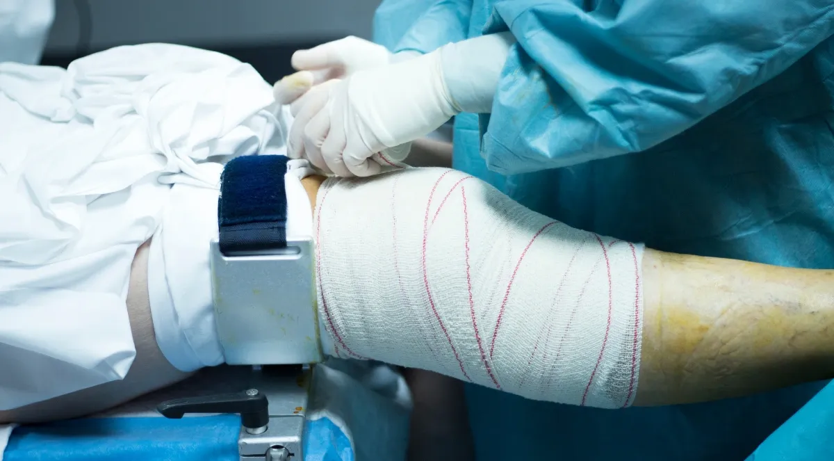How Long to Recover from Knee Arthroscopy Surgery: A Clear Timeline and Expectations