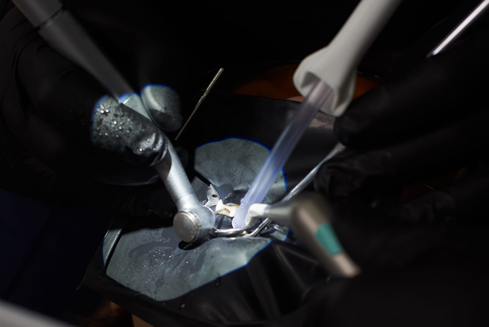 Benefits of Artificial Disc Replacement Surgery: Enhanced Mobility and Pain Relief