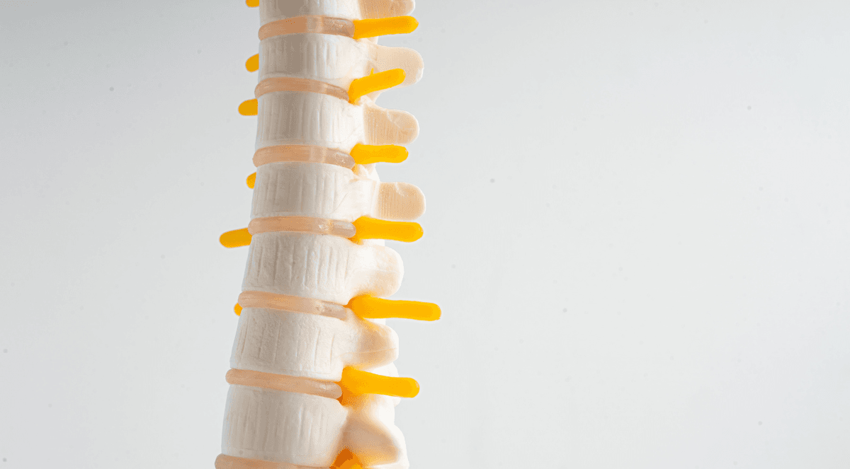 Lumbar Stenosis and Sciatica: Causes, Symptoms, and Effective Treatments