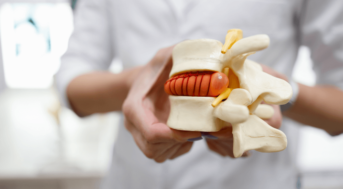Herniated Disk Surgery Cost Mexico: Pricing, Procedures, and Options