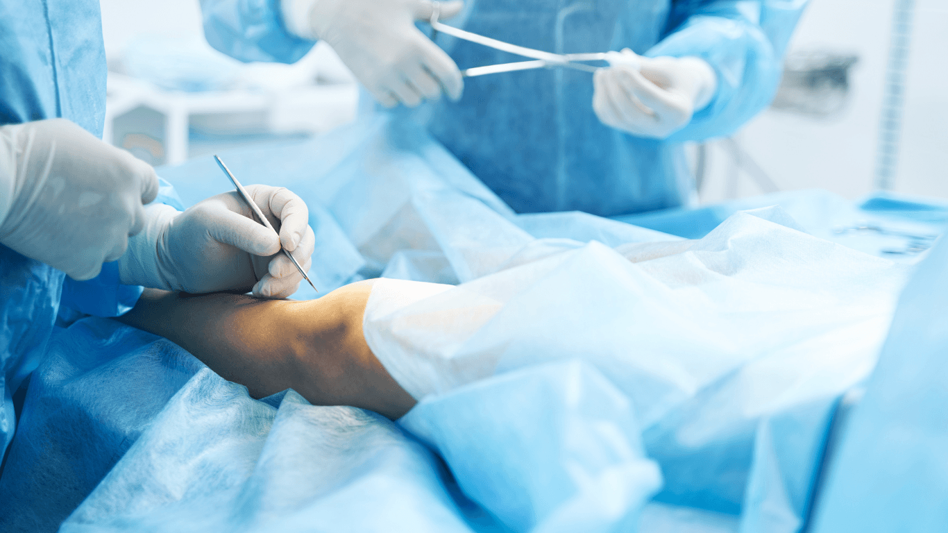 How to Prepare for Knee Replacement Abroad